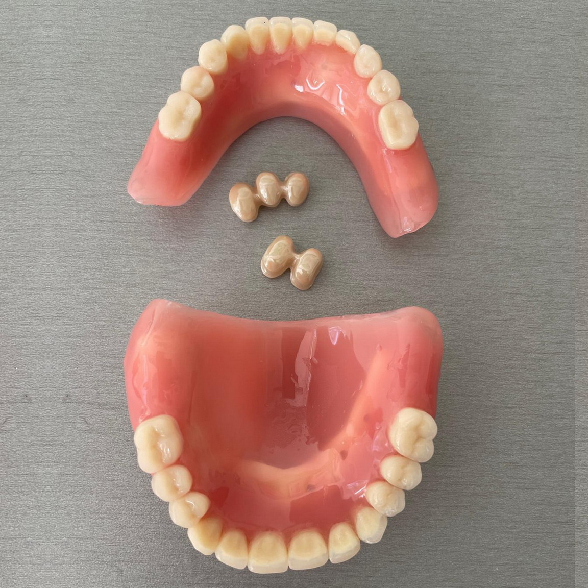 Teleskopická náhrada / Teleskopická práce